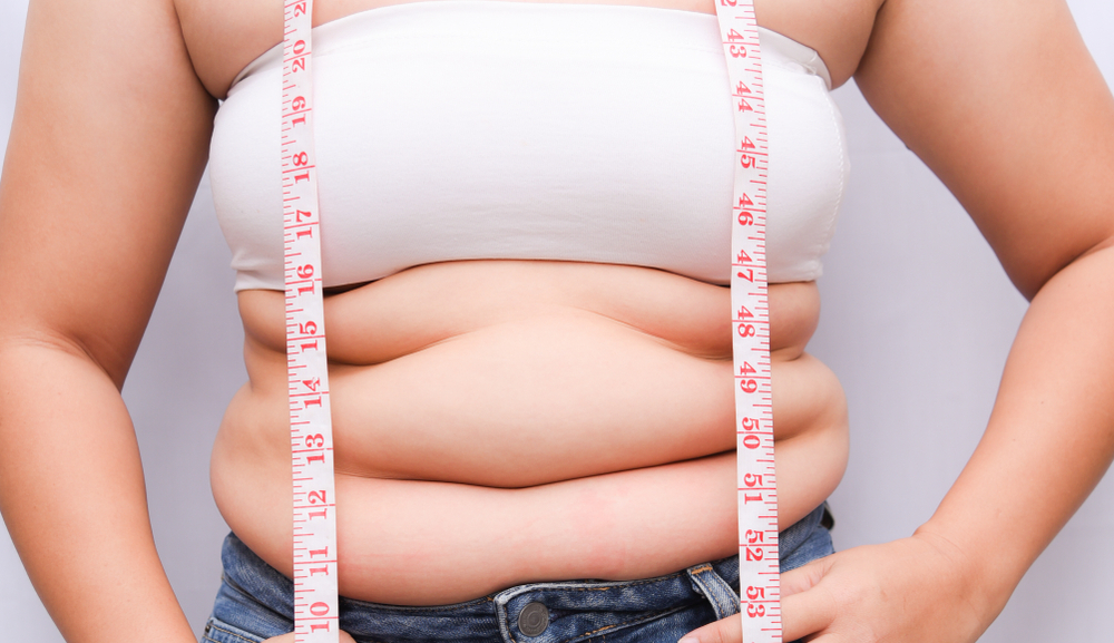 Béo bụng là tình trạng thừa mỡ ở bụng